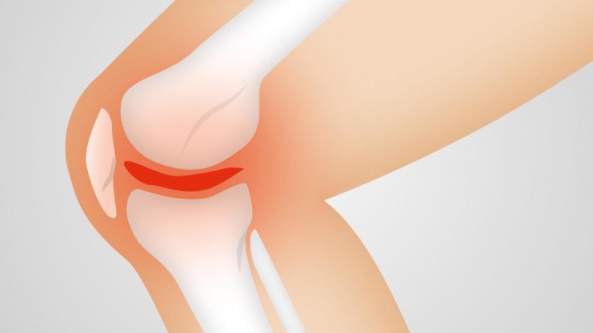 Meniscal injuries